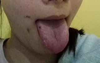 舌头起泡吃瓜疼,揭秘舌头起泡吃瓜的尴尬瞬间