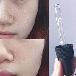 敏感肌吃瓜,轻松享受夏日瓜果盛宴