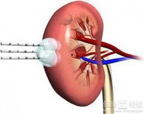 肾癌可以吃线瓜吗,线瓜的适宜与禁忌  第3张